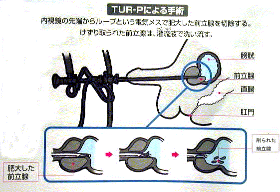 170103][おっぱいゴールド]隣に住む綺麗なおねえさんのプクプク揺れるおっぱいは、いいネ！あー幸せになった気がする。 | 隣に住むきれいなお姉さんの