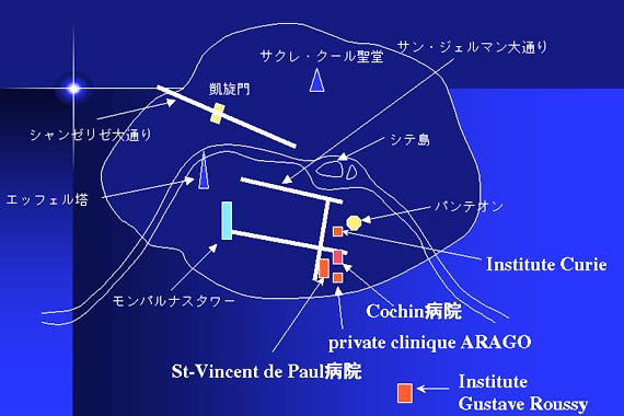 射精の飛距離を測る世界大会「マスターベーソン」とは？飛距離の伸ばし方などを解説 | ザヘルプM