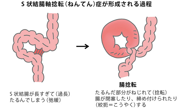 11月】Vtuberがナマでマゾのアナルを拡張してみた。vs.40cm怪物ディルド【S字結腸侵入不可避！？肛門全開（壊）生配信】【ファンクラブ音声】  -