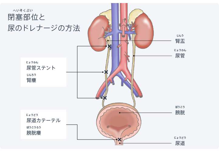 ゲイ動画】尿道カテーテル責め、アナル特大ディルド責め、オラオラ言葉責めに法悦感が止まらないド変態筋肉イケメン！ |  無修正無料ゲイ動画・ビデオ｜G-MENS