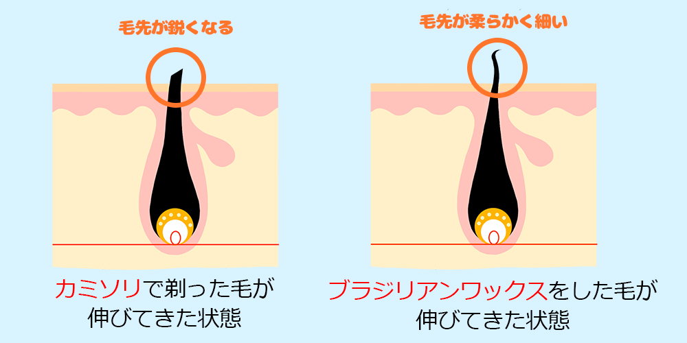 医師監修】ブラジリアンワックス脱毛とは？効果やメリット・デメリットを解説 | Midashinami 身だしなみ