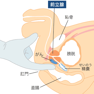 アナル愛撫のやり方！アナルイキや開発方法 - 夜の保健室