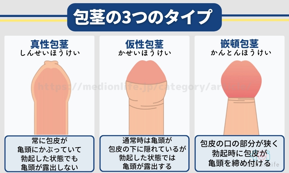 ABCクリニック 神田院 | 包茎や早漏の手術・治療、亀頭増大ならABCクリニック美容外科（公式）