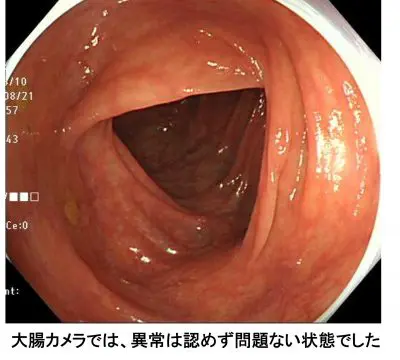 性行為（セックス）後の腹痛（下痢など） | 大阪府豊中市の不妊鍼灸なら、ぽん鍼灸院