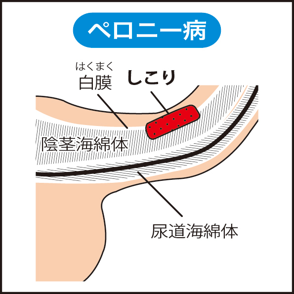 【硬く強く！】海綿体のポテンシャルを120%引き出してガチガチに勃起する方法