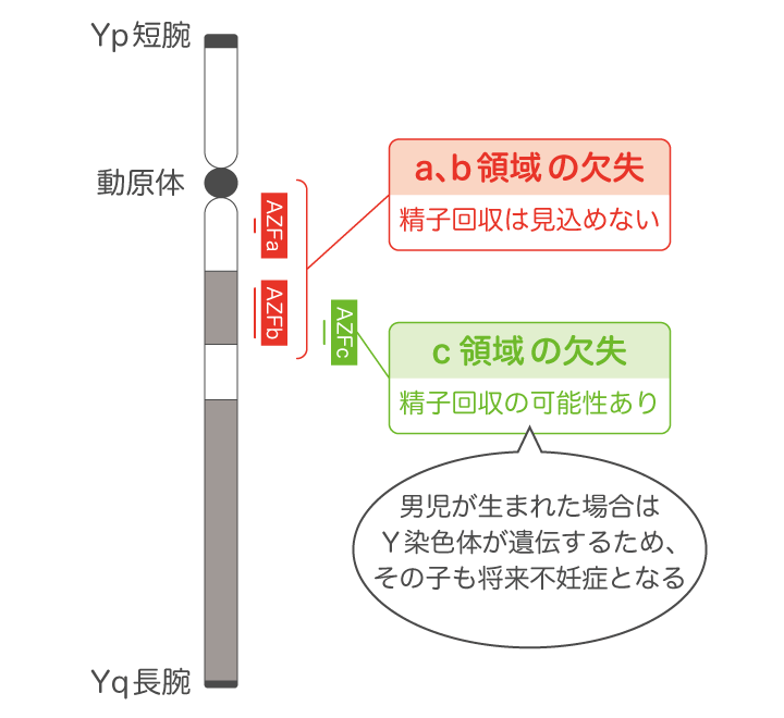 質の良い精子とは？質を高める生活習慣・考え方 | 男性不妊治療は銀座リプロ外科