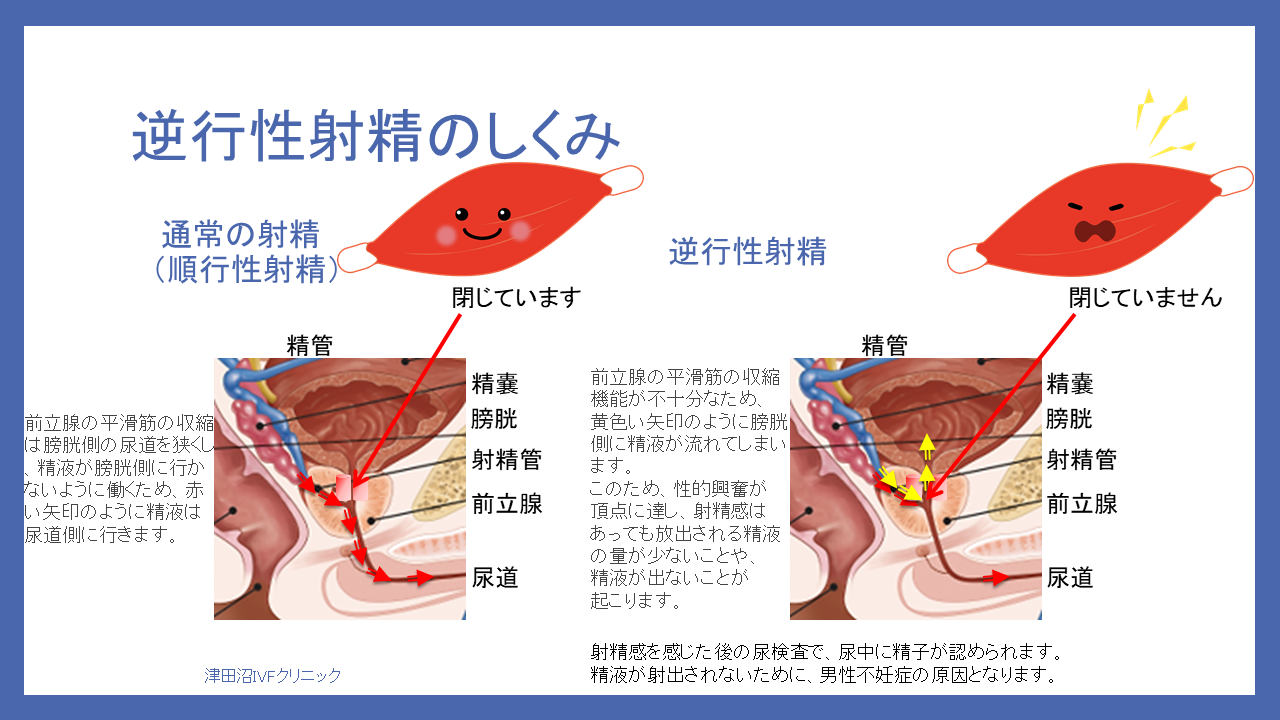 おしっこについて知っていますか | ～笑顔でスッキリ～ おしっこ