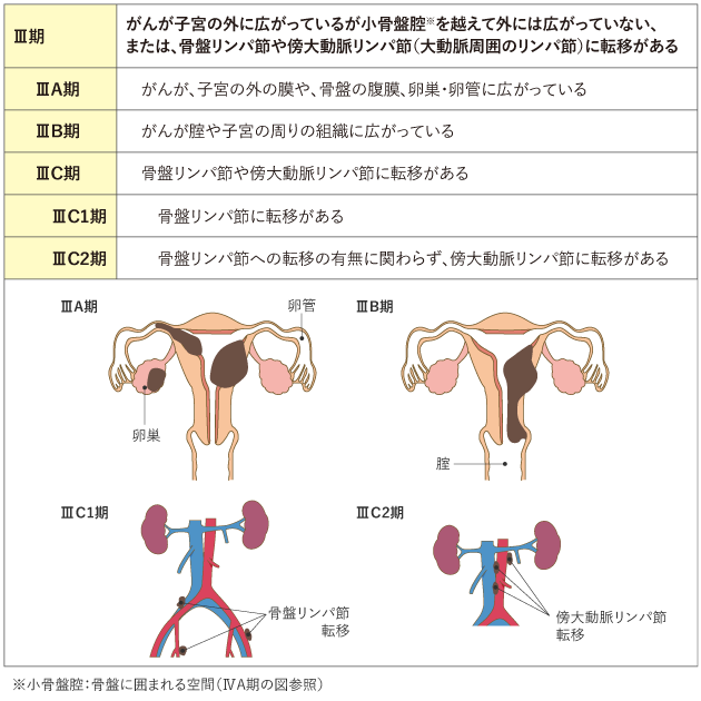 密着取材・体験談】痛い？！『卵管造影検査』に同行してみた（医師の解説＆モニター動画） | ワンモア・ベイビー・ラボ