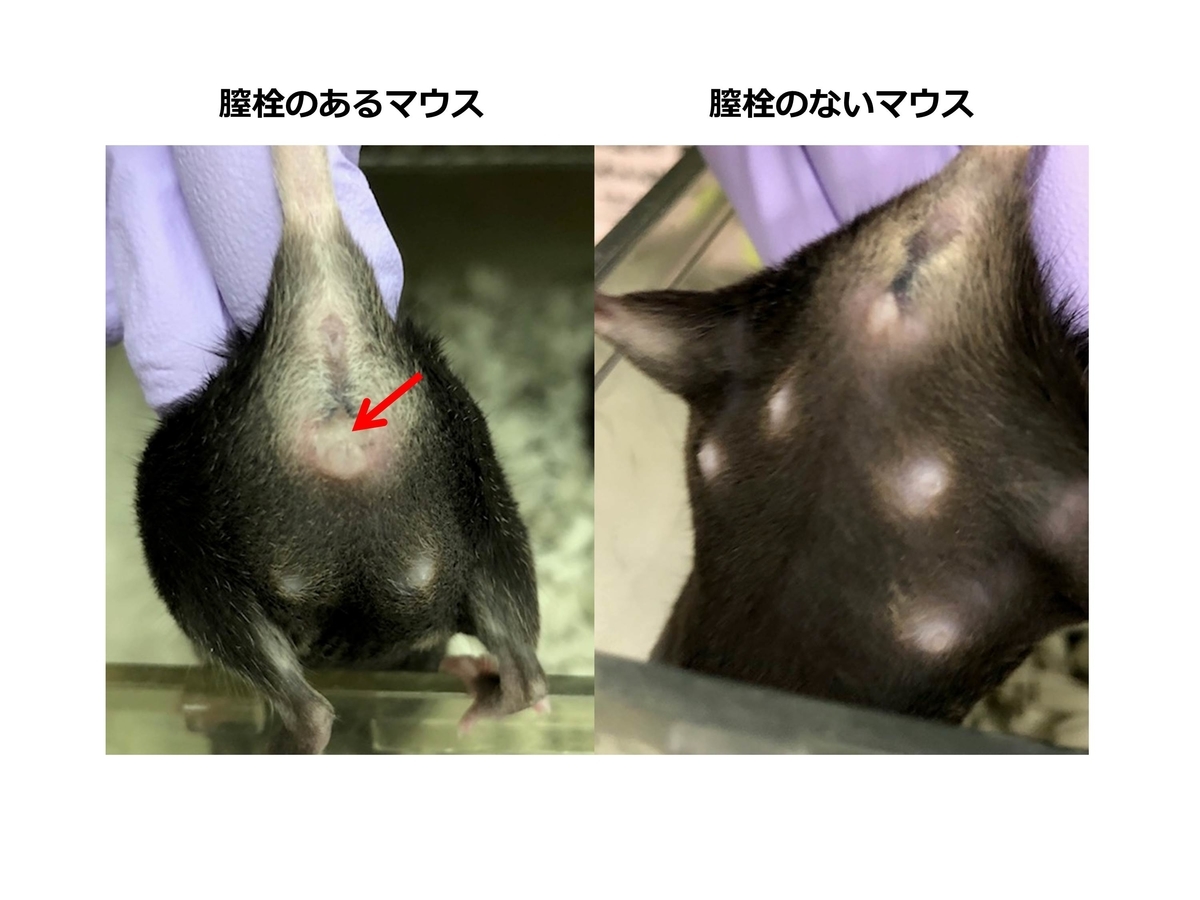 アナル拡張,長さ13cm,巨大なアナルプラグ,膣,アナル拡張,緊縛,マッサージ,セックス玩具 - AliExpress