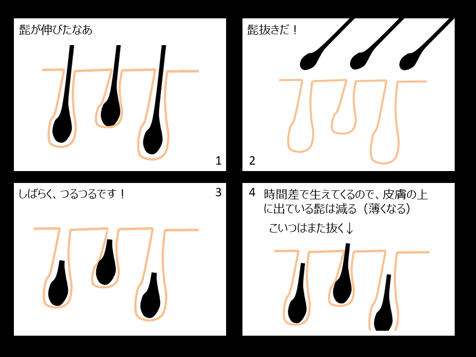 青髭VS毛抜き。抜いても勝てないヒゲの自己処理リスク | 医療脱毛のジュエルクリニック恵比寿【公式】