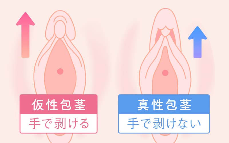 クリトリス勃起とは？勃つ理由とやり方 - 夜の保健室