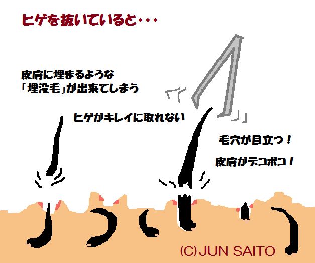 更年期になるとひげが濃くなるのはなぜ？ – 浜田山脱毛MISUMI