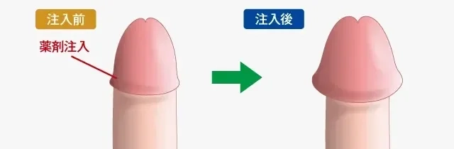 ペニスの大きさ平均は13cm！女性の理想サイズはさらにデカい！？｜薬の通販オンライン