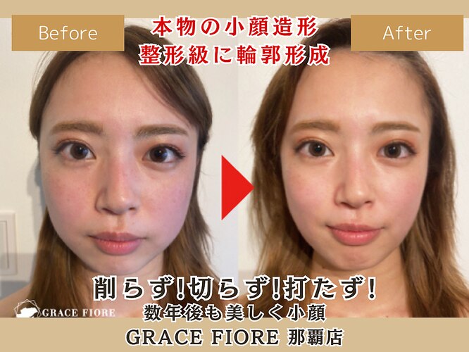 ネット予約可】頭蓋骨小顔矯正サロン gracefiore名古屋栄店 [名古屋市中区/久屋大通駅]｜口コミ・評判