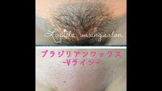 ブラジリアンワックスってどんなもの？デリケートゾーン脱毛の基本知識を解説 | Shinagawa Beauty Navi