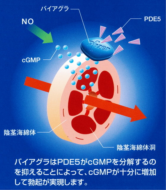 陰茎海綿体注射は持続勃起に注意！ | メンズ専門