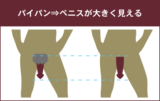 男でも陰毛処理を綺麗にする10の脱毛方法【男もパイパンで勝負】 | 女性用性感マッサージ「リップス」