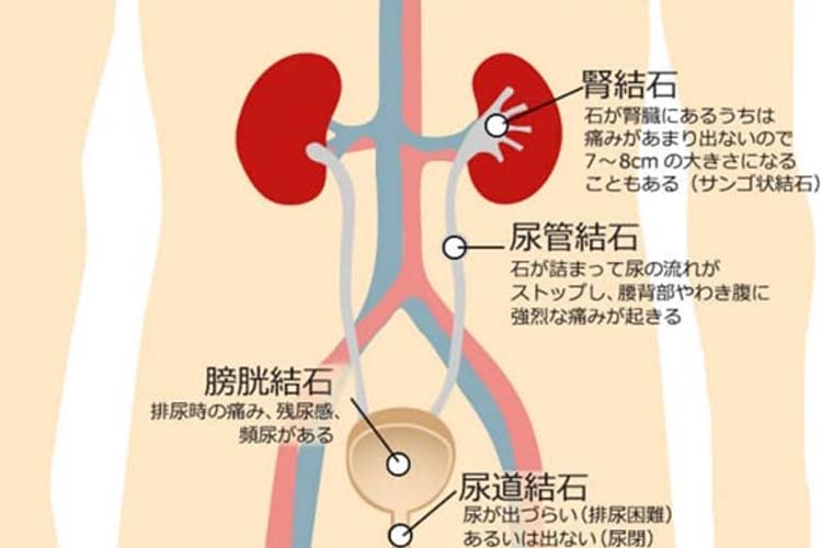 それって前立腺肥大症かも？