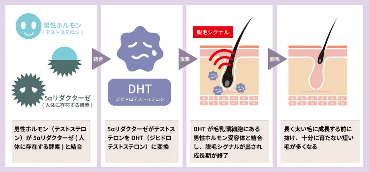 オナニーが髪に与えるデメリットとは？薄毛や抜け毛になるのかを解説 | 駅前AGAクリニック【新宿、北千住、大阪、京都、岡山、鹿児島など】