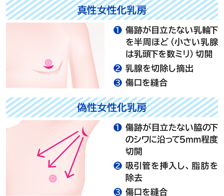 GUSHmaniaEX 敏感おちくびｖ - honto電子書籍ストア