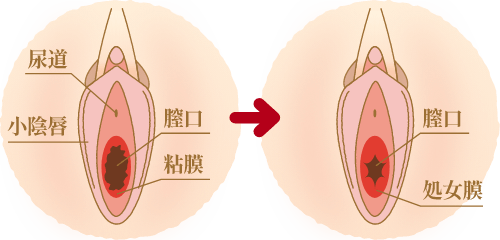 まるごと小陰唇 ギャル - オナホール