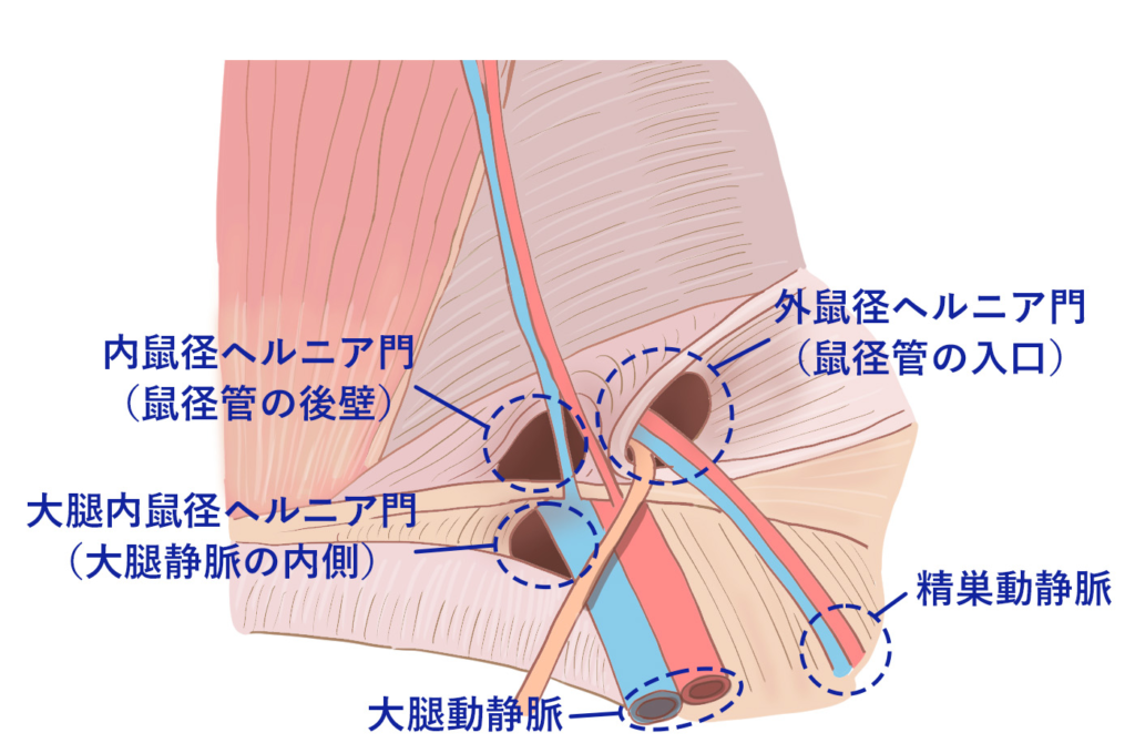 鼠径ヘルニア日帰り外科広島アルプスクリニック | 鼠径ヘルニア日帰り外科広島アルプスクリニックは、【広島駅徒歩5分】にある鼠径 ヘルニア・脱腸の日帰り手術専門クリニックです。身体への負担が少ない、日帰り腹腔鏡手術で、治療しています。