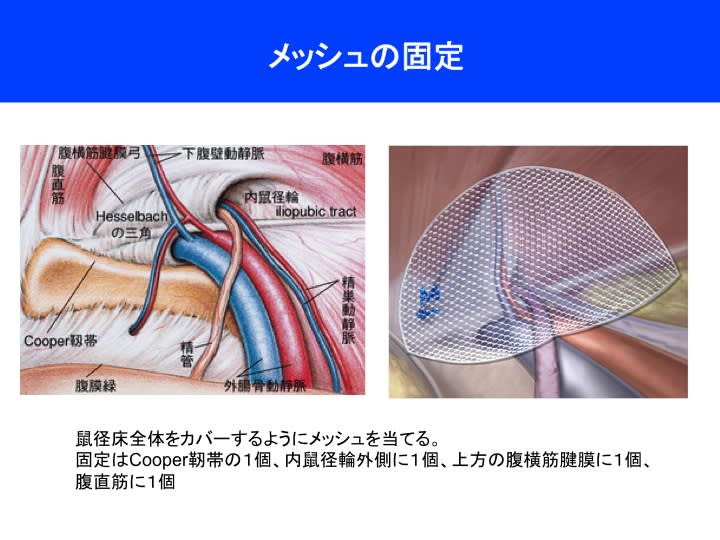 クーパー靱帯とは？伸びる・切れる原因や再生可能か詳しく解説！ | 銀座マイアミ美容外科