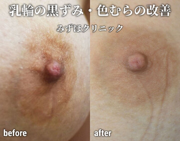 乳輪20センチ | 写真で一言ボケて(bokete)