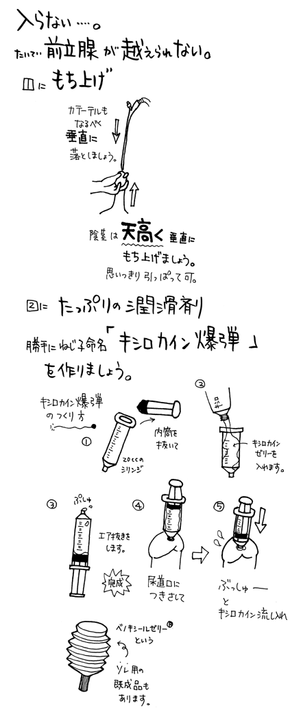 尿がでにくい・尿の勢いが弱い（排尿困難） | みうら泌尿器科クリニック