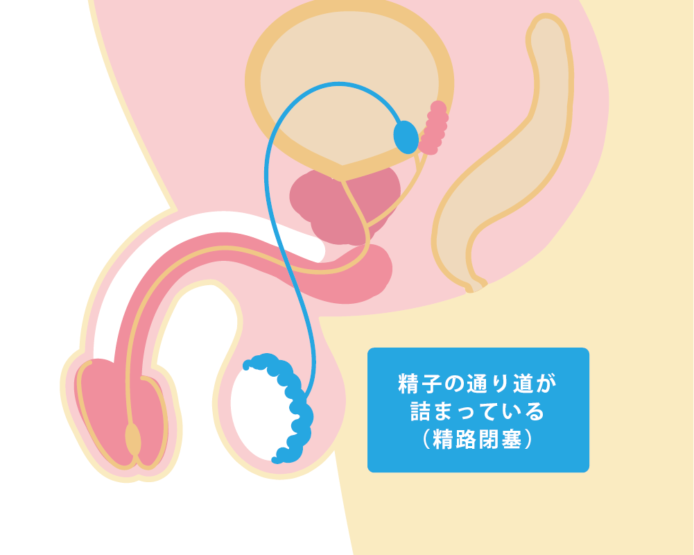 あなたの知らない精液の味: パートナーの男性力がアップする | 望月　さゆみ,