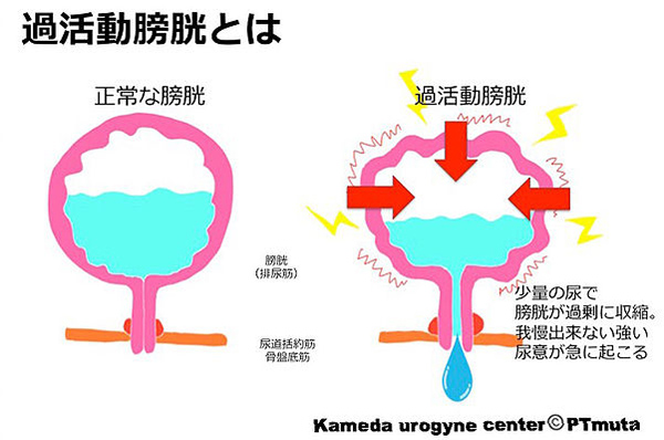 ガイドラインに基づいた前立腺肥大症の正しい知識と治し方 | 同友会メディカルニュース