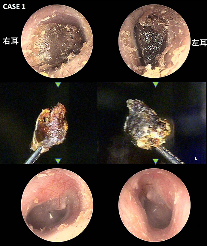 見てわかる耳の病気 耳鼻咽喉科内藤クリニック