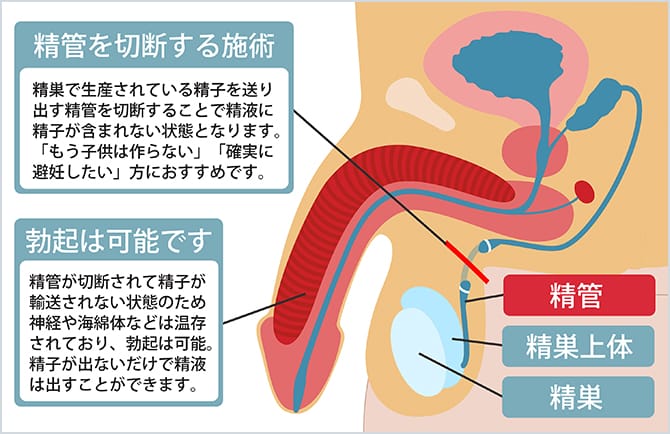 ペニスを勃起しやすくするには？勃起力低下の原因とともに解説 |【公式】ユナイテッドクリニック