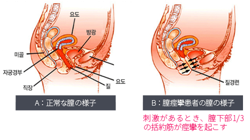 【都市伝説】膣痙攣で男性器が抜けなくなる！？　#shorts