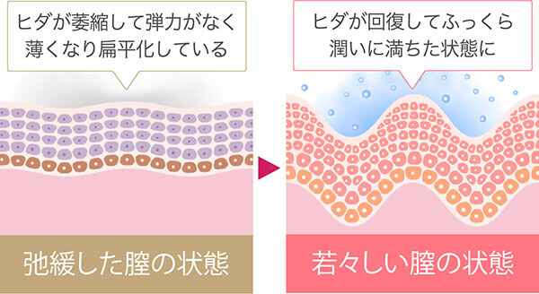 腟ナラ】セックス中や運動中に「腟からおならが出る」これって何？改善できるの？泌尿器科医に聞いた | ヨガジャーナルオンライン