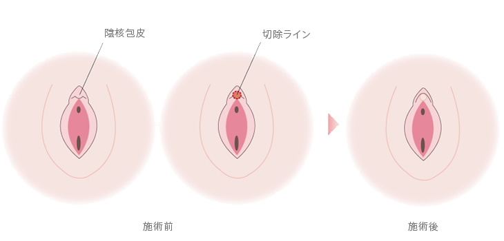 敏感な部分をピンポイントで刺激する！クリトリス＆乳首＆亀頭マッサージローター［0173］ ストア