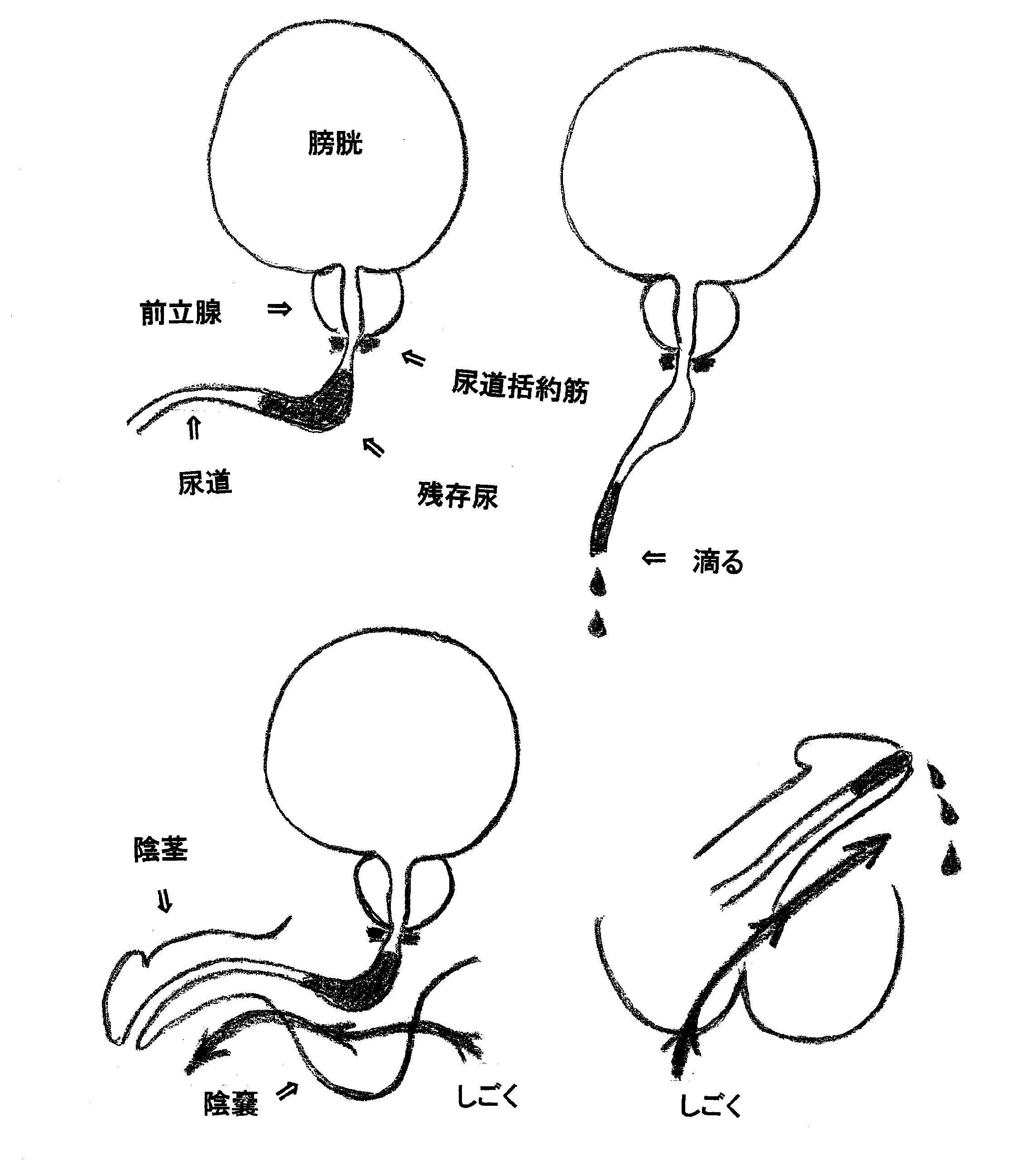 それって前立腺肥大症かも？