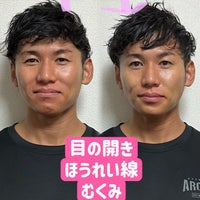 インセンティブ有】港区エステサロンの美容鍼灸師｜株式会社ティアグループ｜東京都港区の求人情報 - エンゲージ