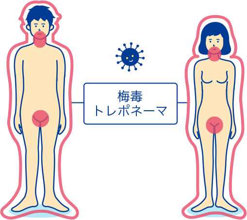 注意！】梅毒の感染者がとても増えています（症状に関する写真も掲載しています） - 福岡県庁ホームページ