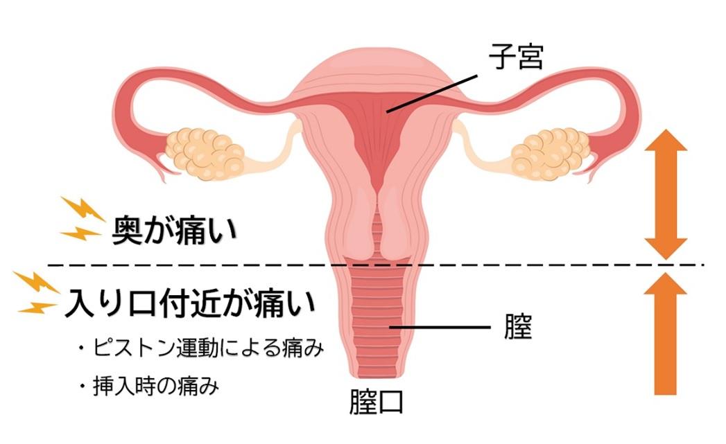 後背位（バック）のやり方を画像で解説 | 寝バック・立ちバックなども紹介