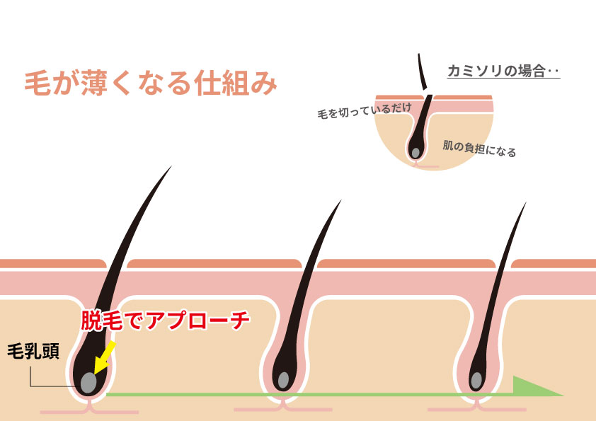 頬ヒゲが濃くなる原因とは？自己処理のコツや脱毛のメリットも紹介！ | お役立ち情報