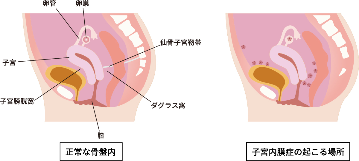 ニューハーフ】スレンダー美人がおじさんのアナルにチンポ突っ込んで激ピスSEX。 FC2-PPV-3435379