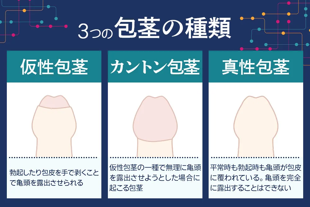 ABCクリニック神田院の口コミ・評判は良い悪い？他社と比較しながら徹底評価！ | bmrctr.jp