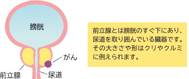 キングジム おぼつかない ラベルライター テプラPRO ガーリーテプラ