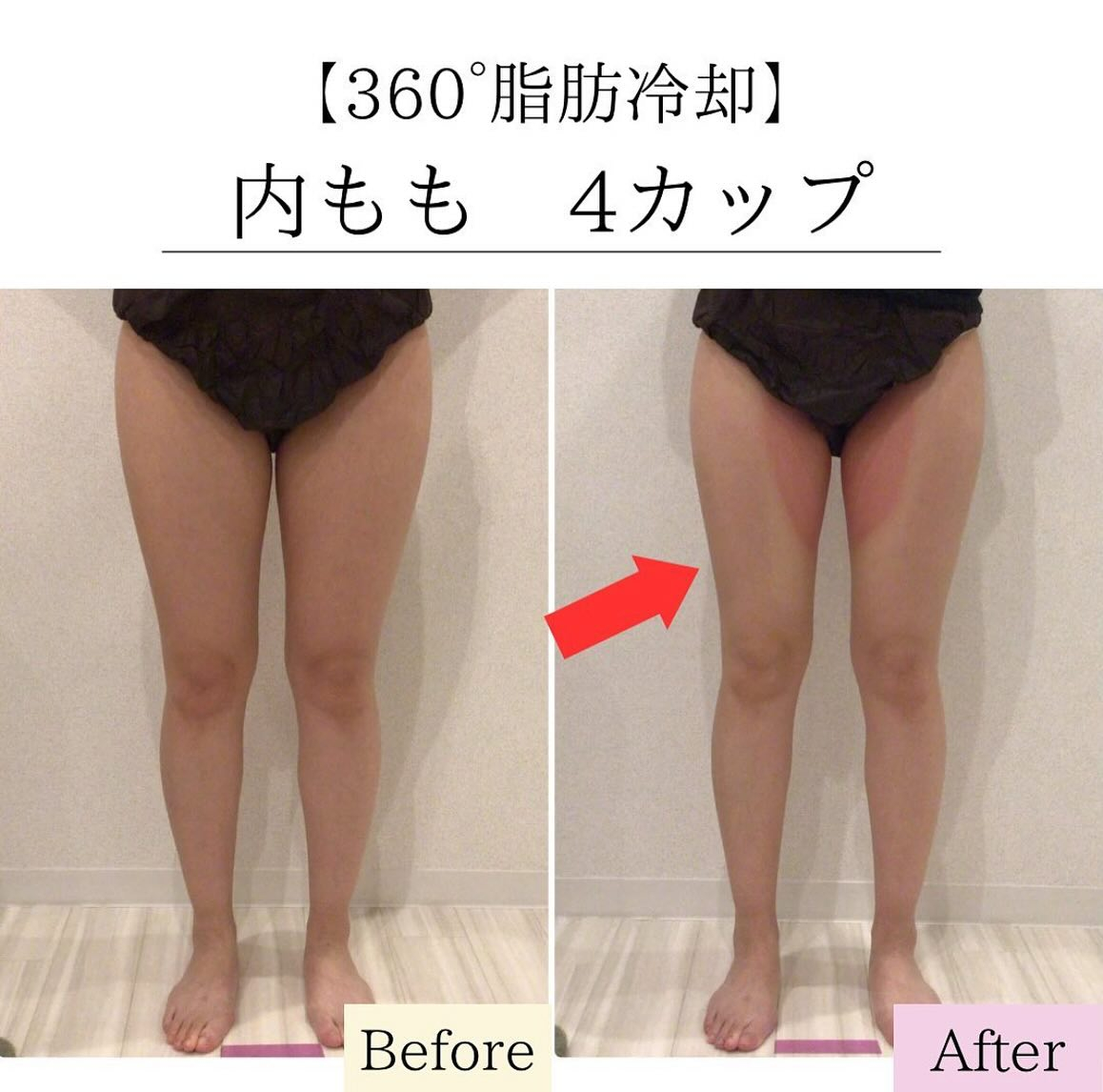 クサドメトモコ │ ダイエット講師 │ 鹿児島ダイエット専門エステサロン経営