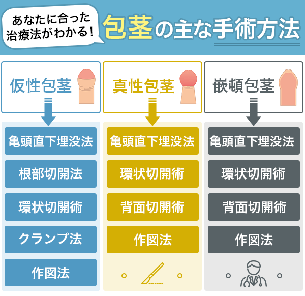 包茎手術 | 術後の痛み・腫れ・経過・傷跡について |