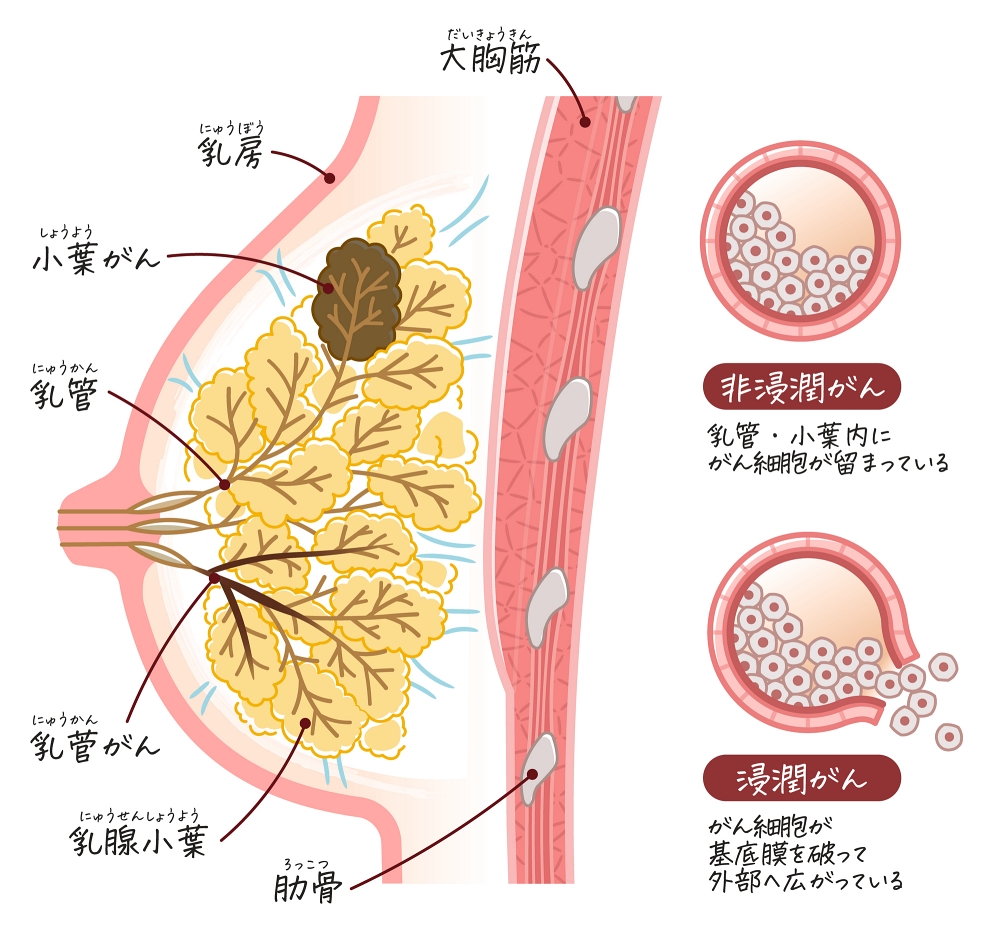 VIO脱毛中に勃起をしてしまったらどうする？施術中の勃起を防ぐ方法も解説します│メンズジェニー