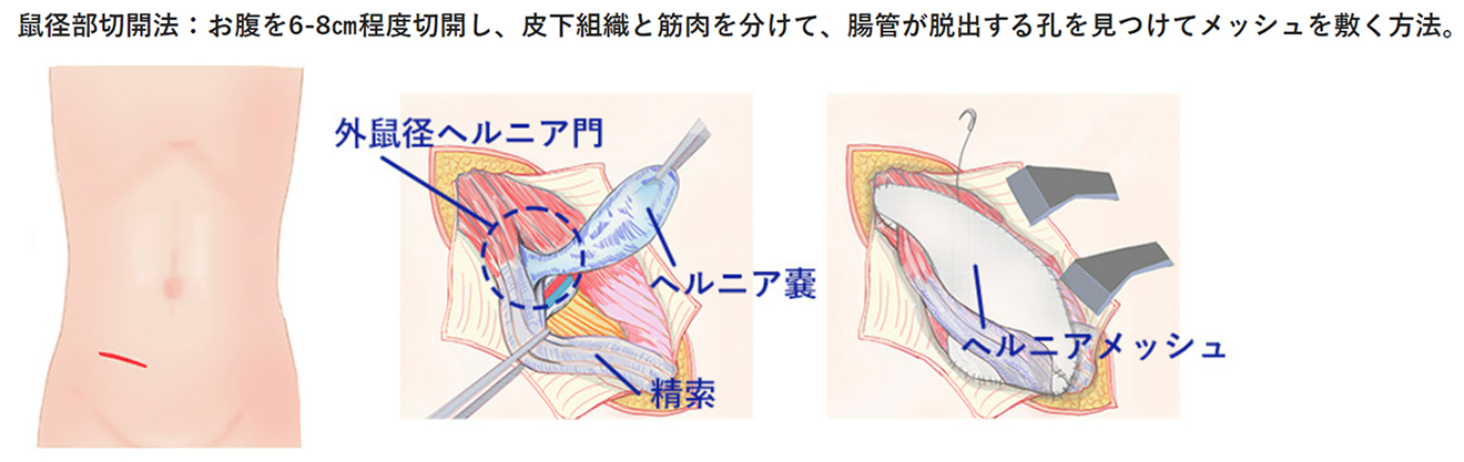 骨盤・股関節・鼠径部のスポーツ疾患治療の科学的基礎 （Sports　physical　therapy　semina）