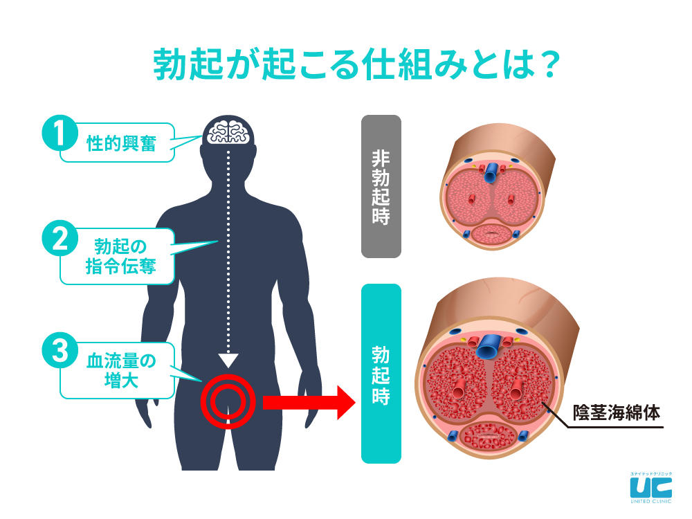 勃起を抑える 3つの方法 - wikiHow