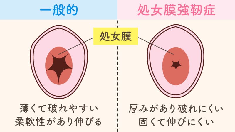 中イキできる！おすすめの大人のおもちゃ10選！人気のポルチオバイブ＆Gスポットバイブから口コミで厳選 |  アダルトグッズ・大人のおもちゃ通販の「ラブトリップ」公式ブログ